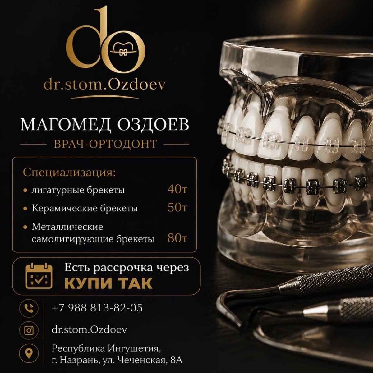 Установка брекет систем